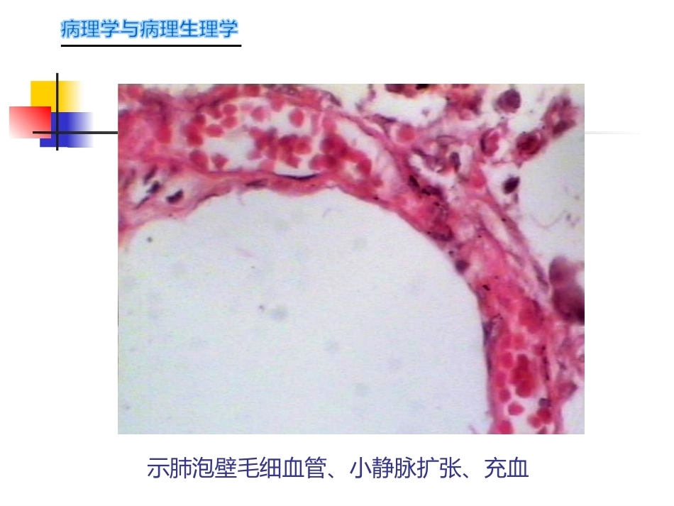 局部血液循环障碍病理学_第15页