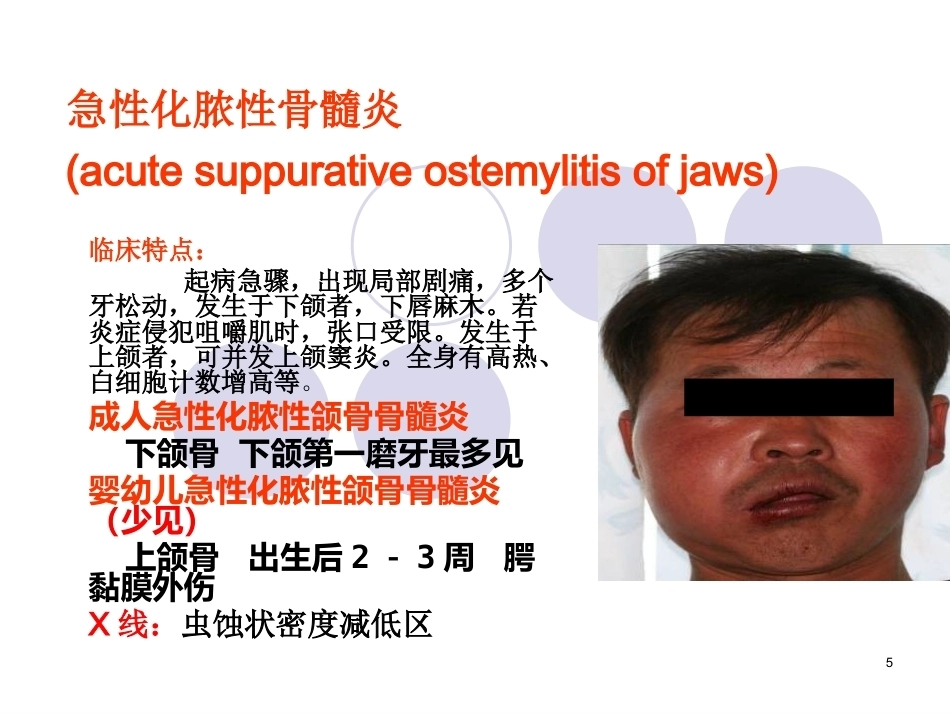口腔组织病理学课件颌骨疾病_第5页