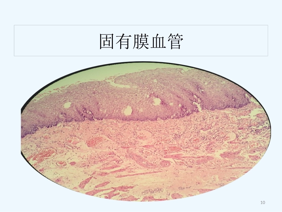 早期食管黏膜病变病理学形态_第10页