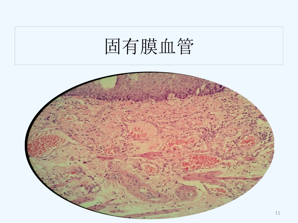 早期食管黏膜病变病理学形态_第11页