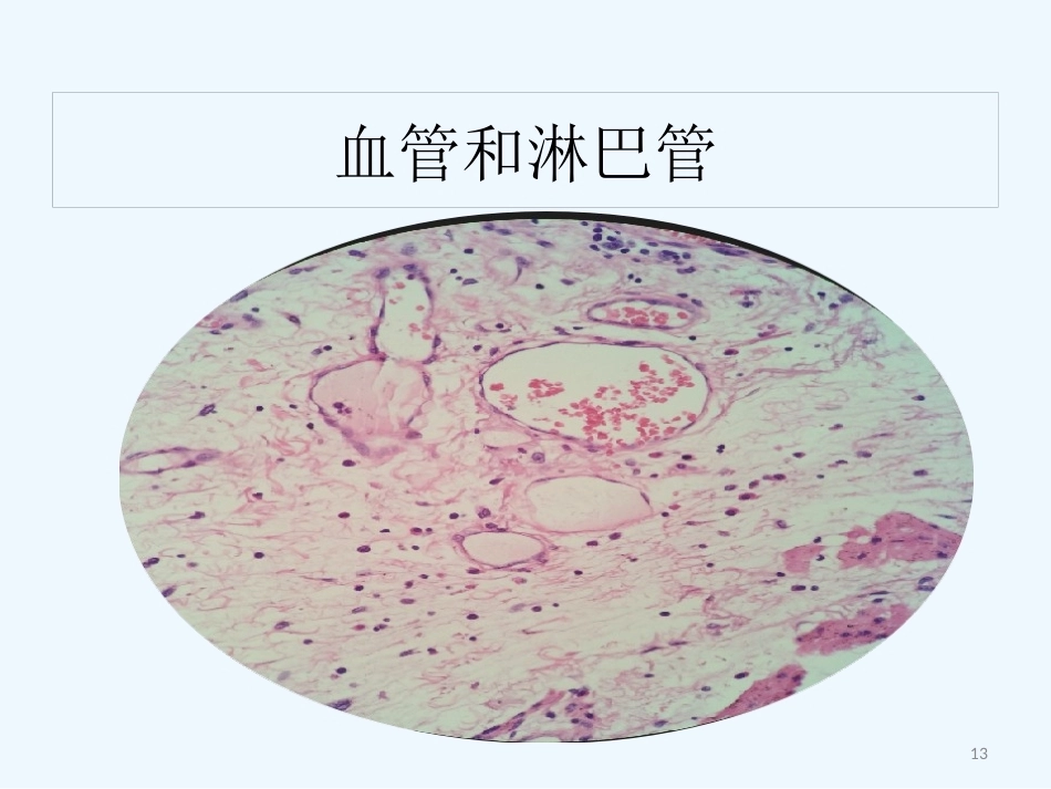 早期食管黏膜病变病理学形态_第13页