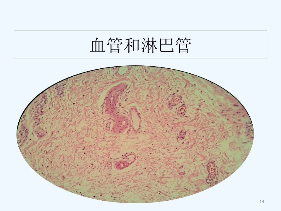 早期食管黏膜病变病理学形态_第14页