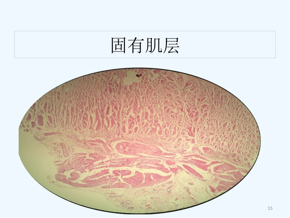 早期食管黏膜病变病理学形态_第15页
