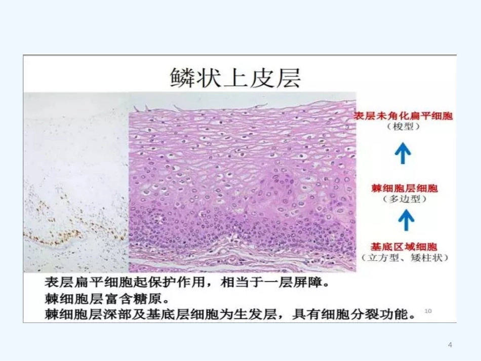早期食管黏膜病变病理学形态_第4页