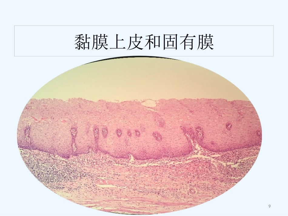 早期食管黏膜病变病理学形态_第9页