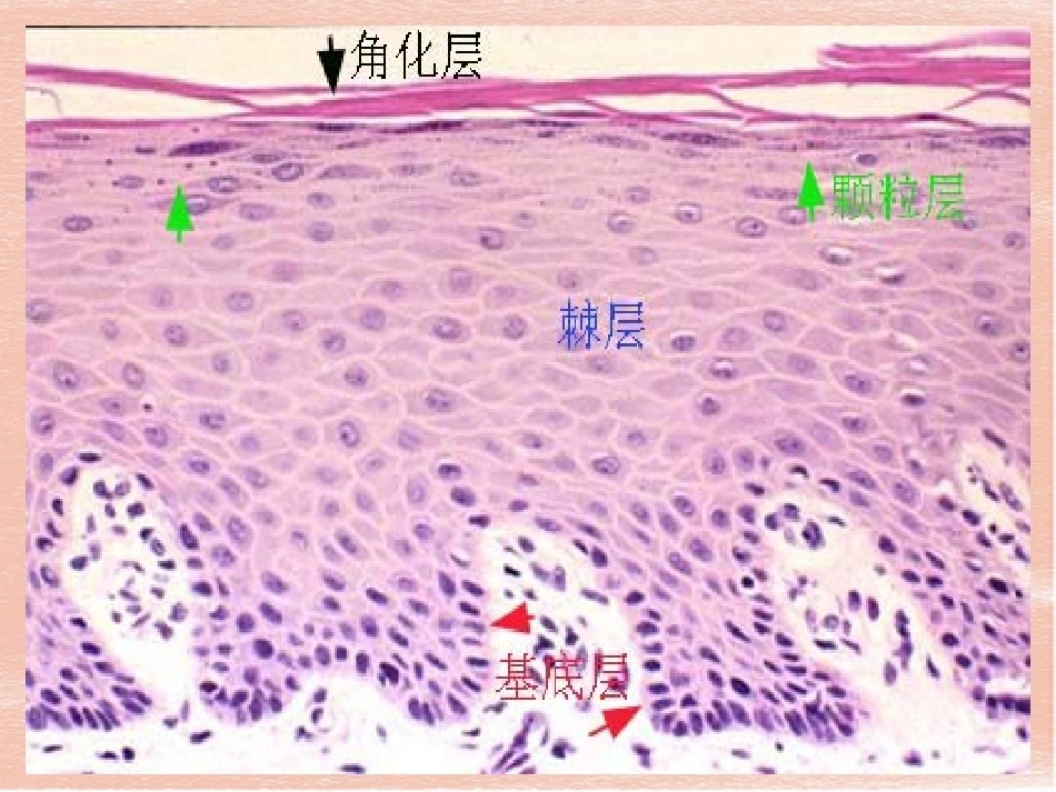 口腔组织病理学-口腔黏膜_第6页