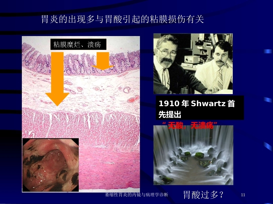 萎缩性胃炎的内镜与病理学诊断_第11页