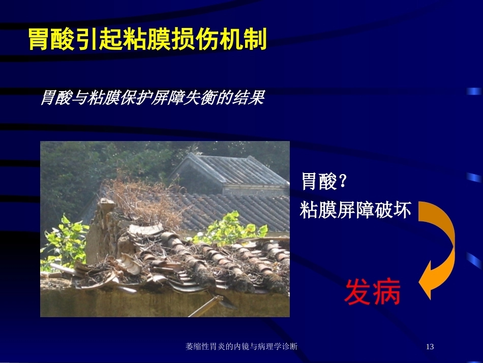 萎缩性胃炎的内镜与病理学诊断_第13页