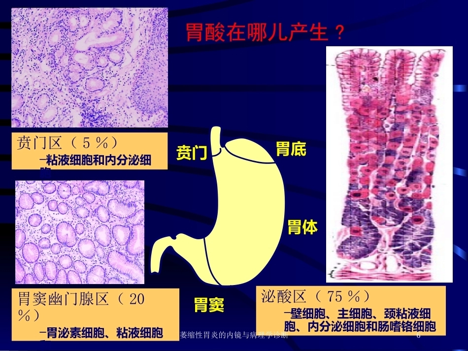 萎缩性胃炎的内镜与病理学诊断_第6页