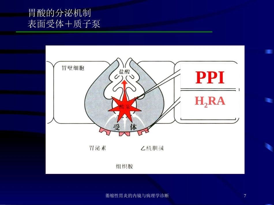 萎缩性胃炎的内镜与病理学诊断_第7页