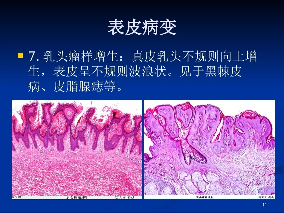 皮肤组织病理学PPT课件_第10页