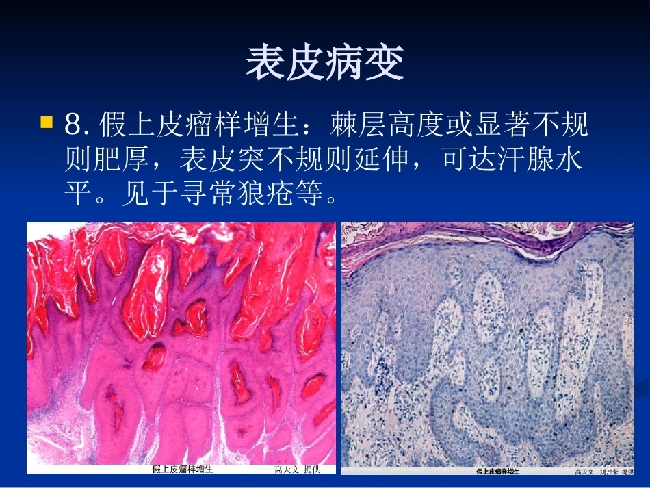皮肤组织病理学PPT课件_第11页