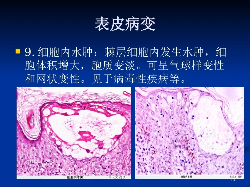 皮肤组织病理学PPT课件_第12页