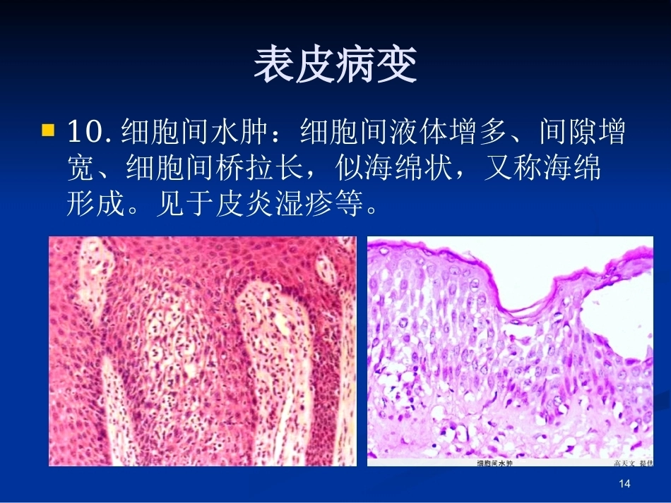 皮肤组织病理学PPT课件_第13页