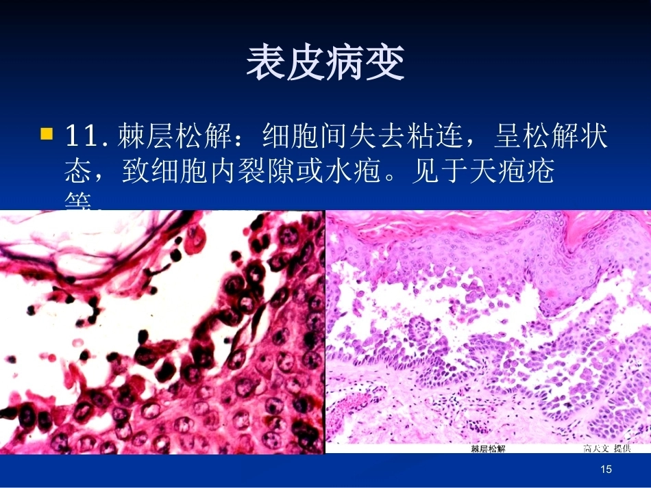 皮肤组织病理学PPT课件_第14页