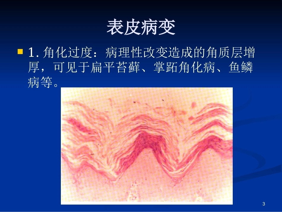 皮肤组织病理学PPT课件_第3页