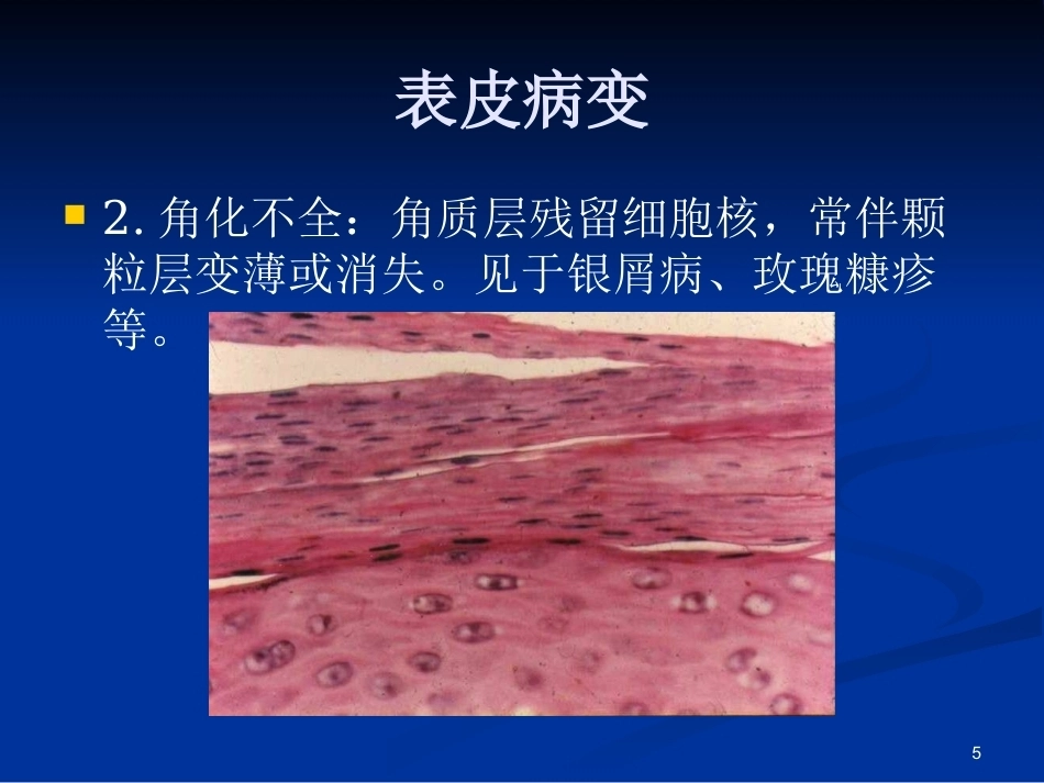皮肤组织病理学PPT课件_第5页