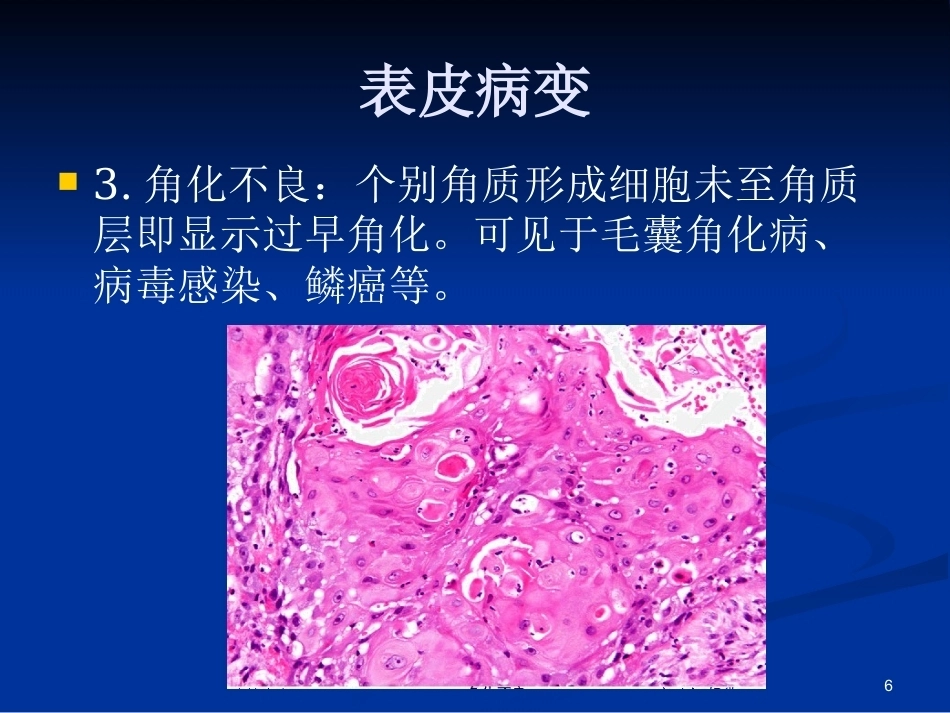 皮肤组织病理学PPT课件_第6页