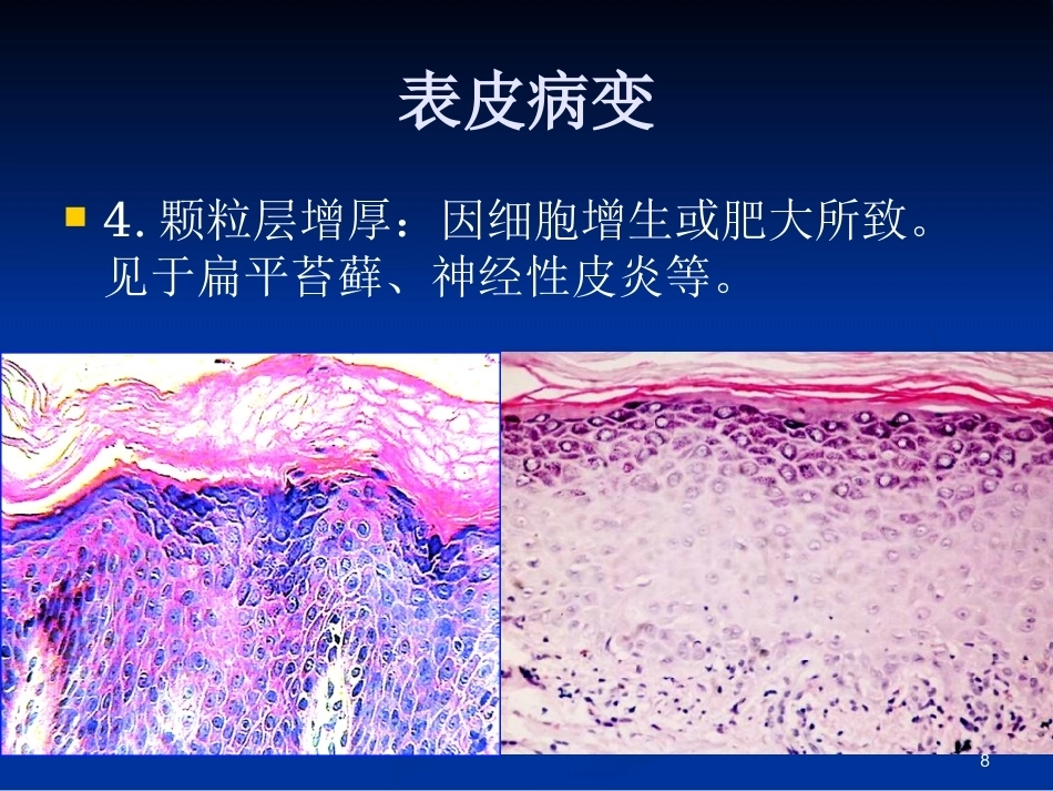 皮肤组织病理学PPT课件_第7页