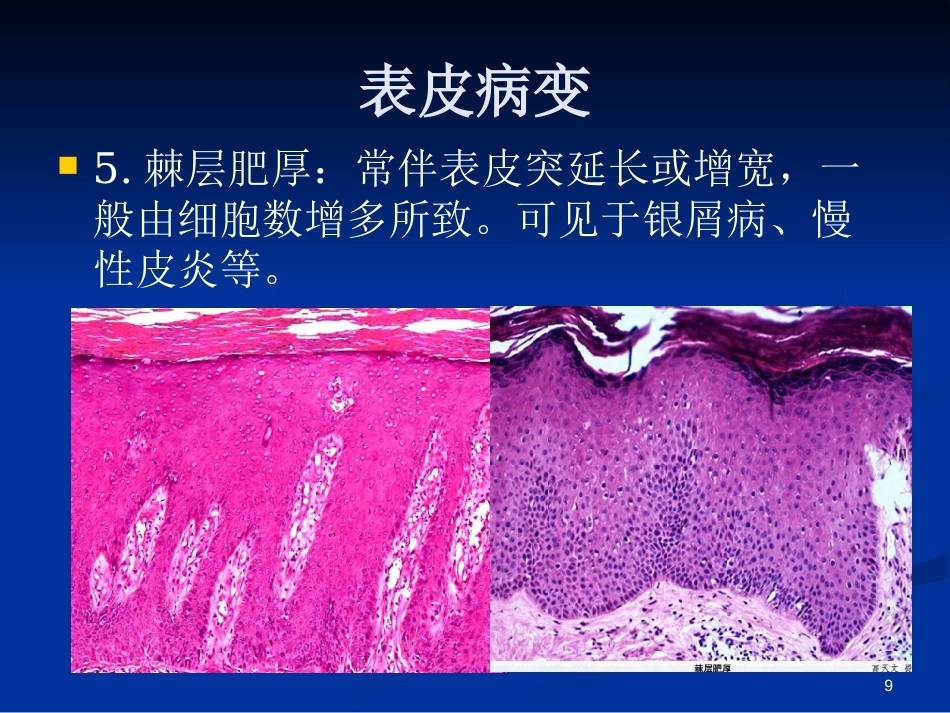 皮肤组织病理学PPT课件_第8页