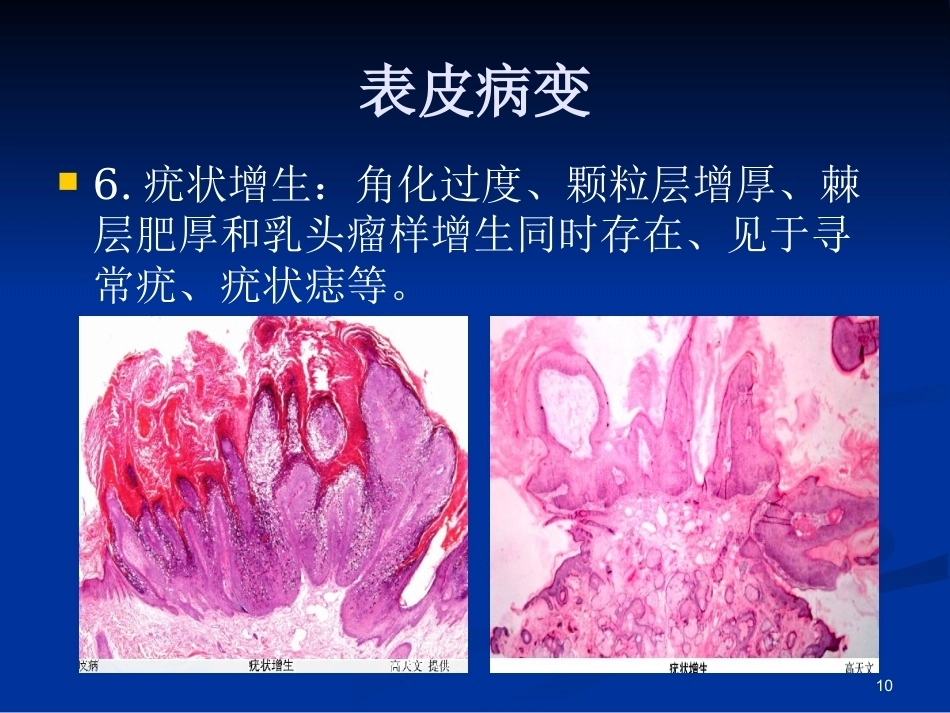 皮肤组织病理学PPT课件_第9页