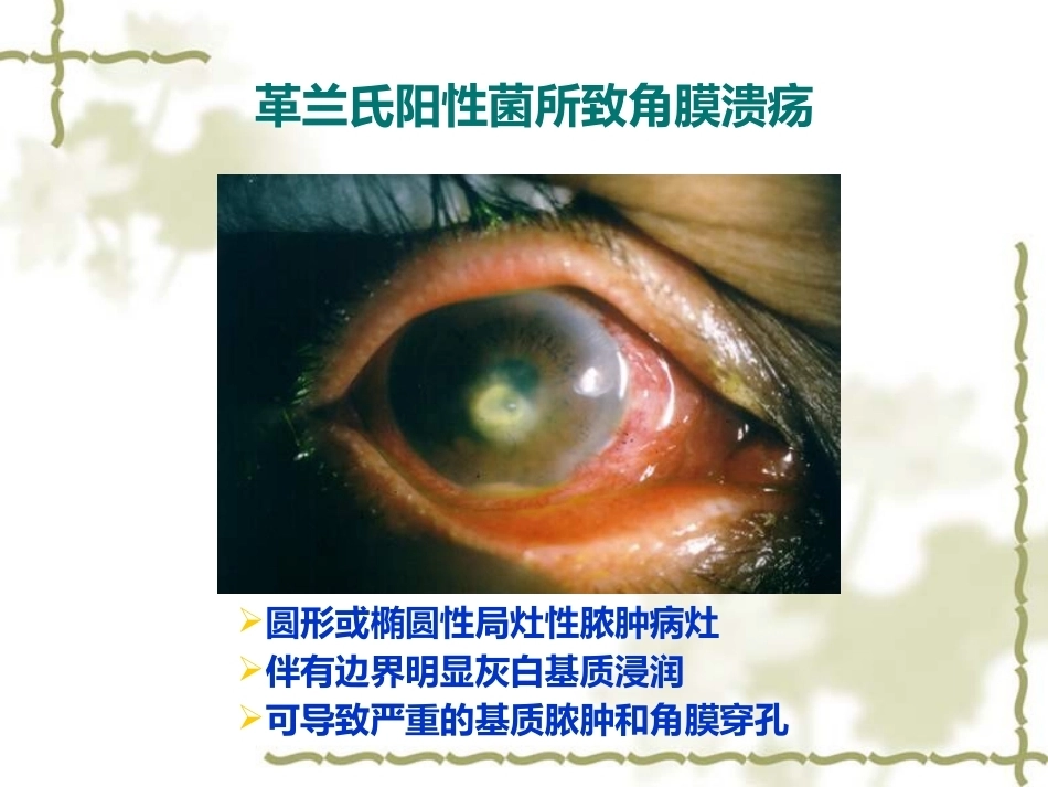 眼科病理学_第12页