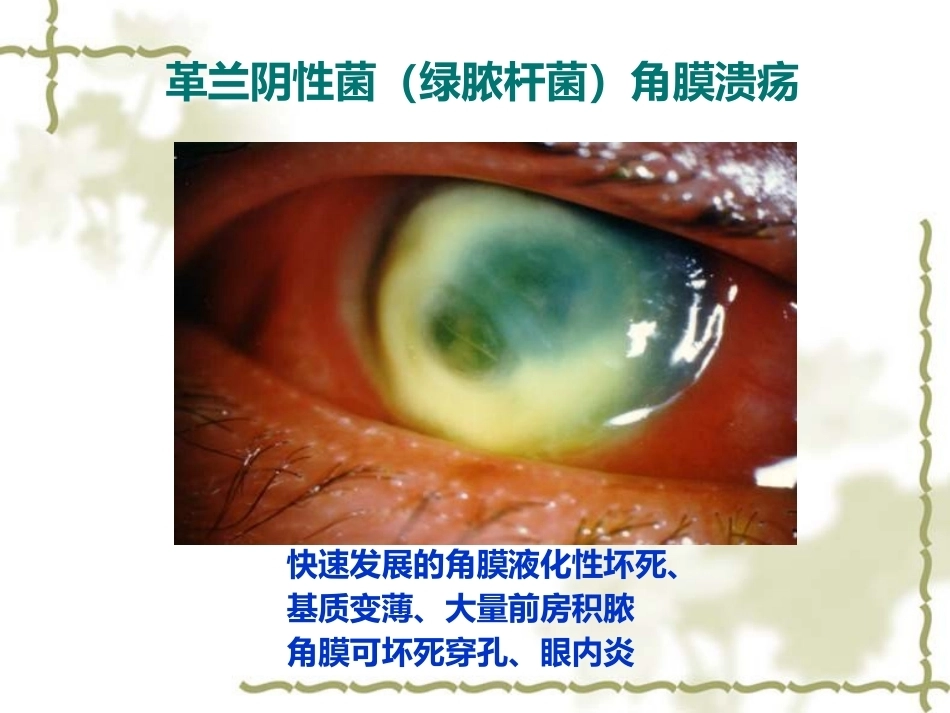 眼科病理学_第13页