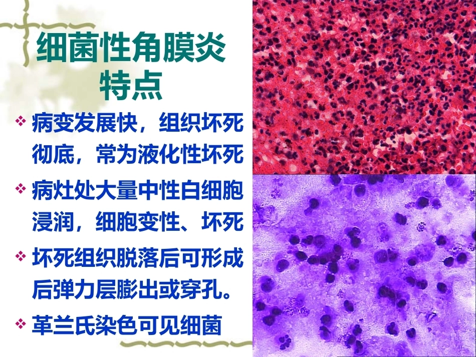 眼科病理学_第14页