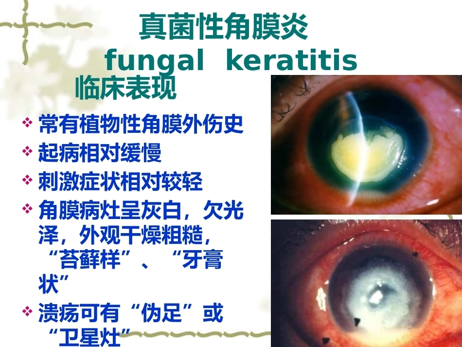 眼科病理学_第15页