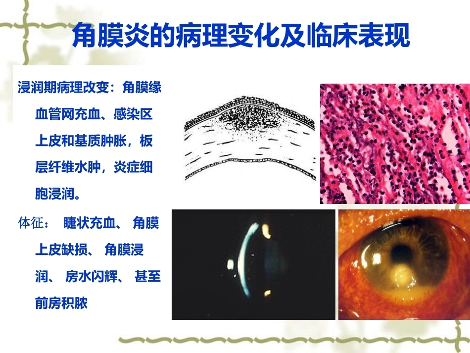 眼科病理学_第5页