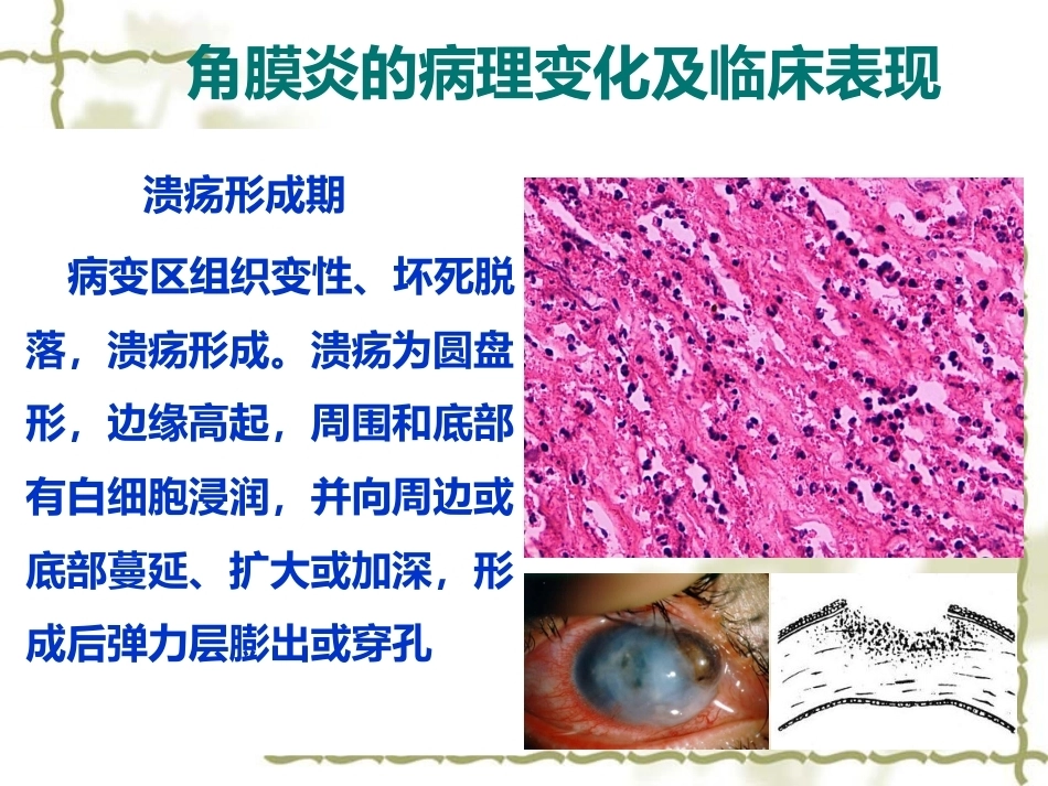 眼科病理学_第6页