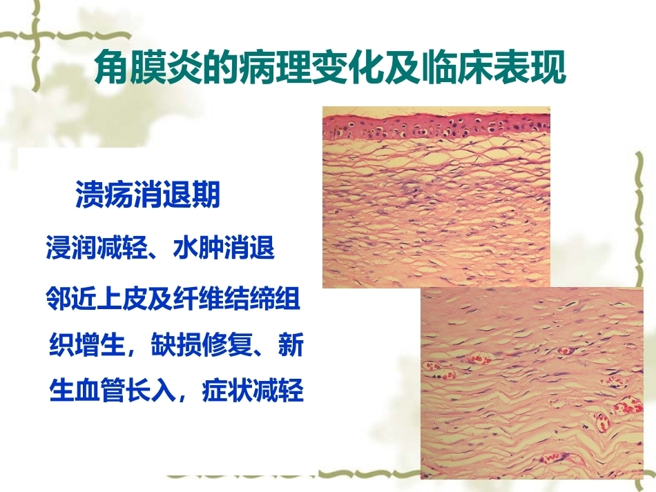 眼科病理学_第7页