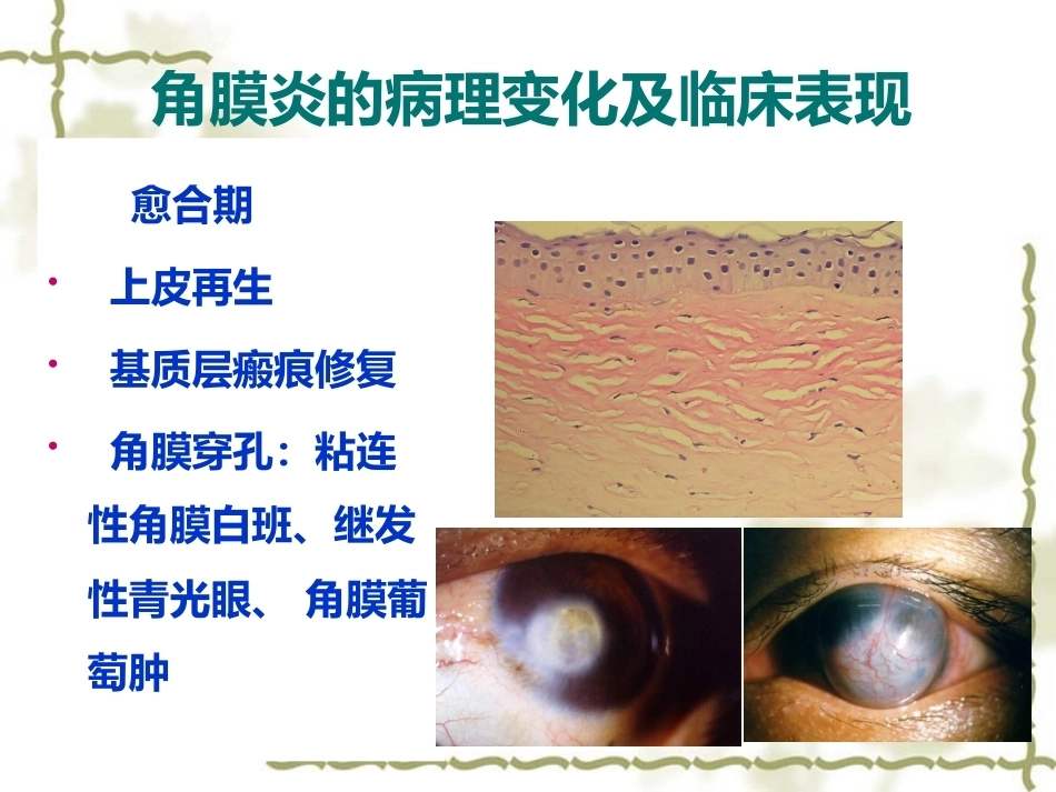 眼科病理学_第8页