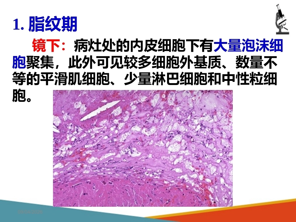 心血管系统疾病—动脉粥样硬化(病理学课件)_第4页