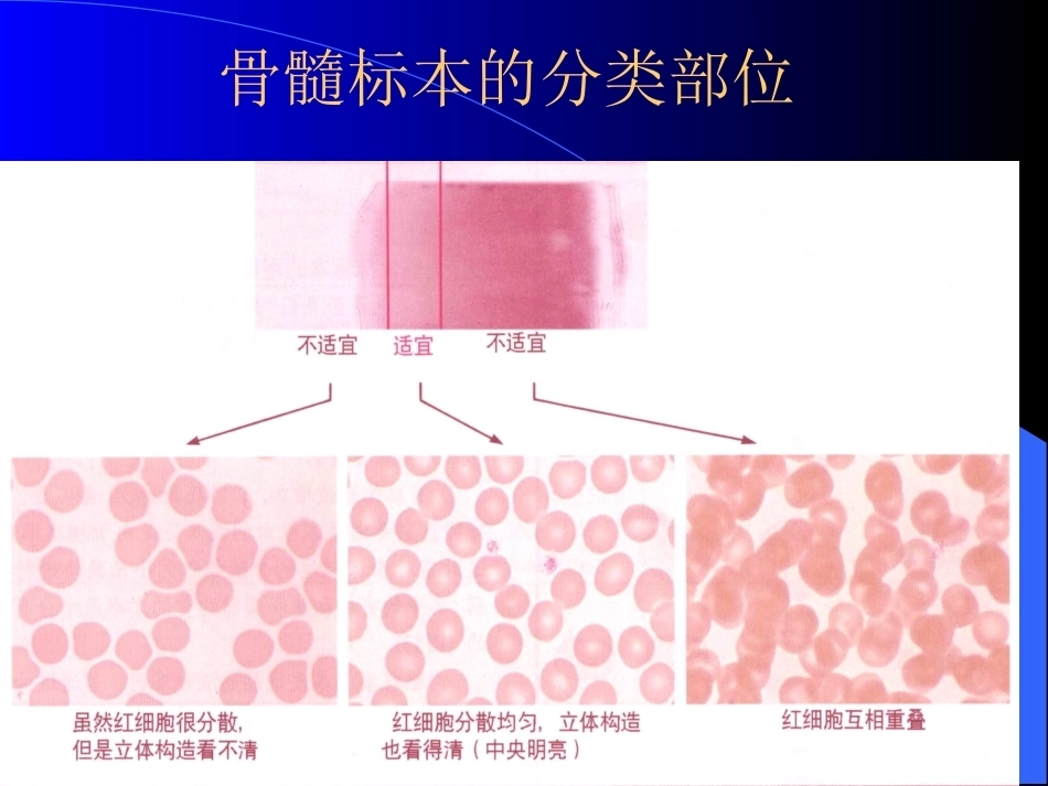 骨髓细胞学检查_第10页