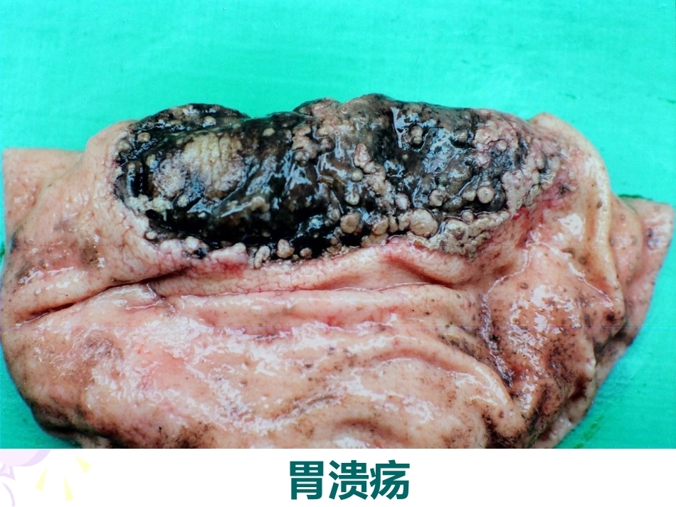 兽医病理学PPT 消化系统病理_第15页