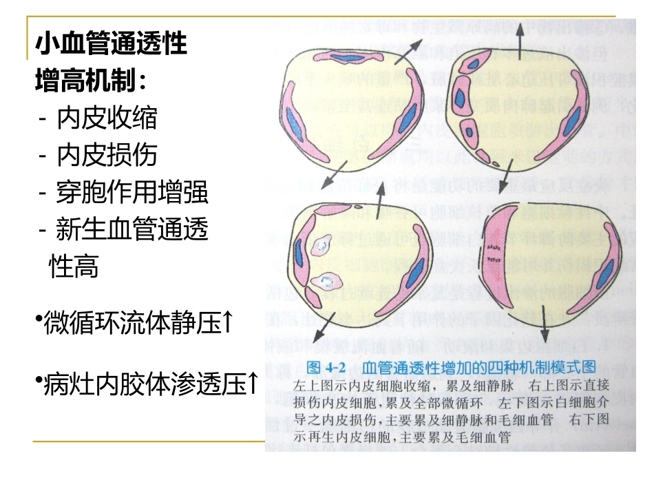 炎症病理学_第10页
