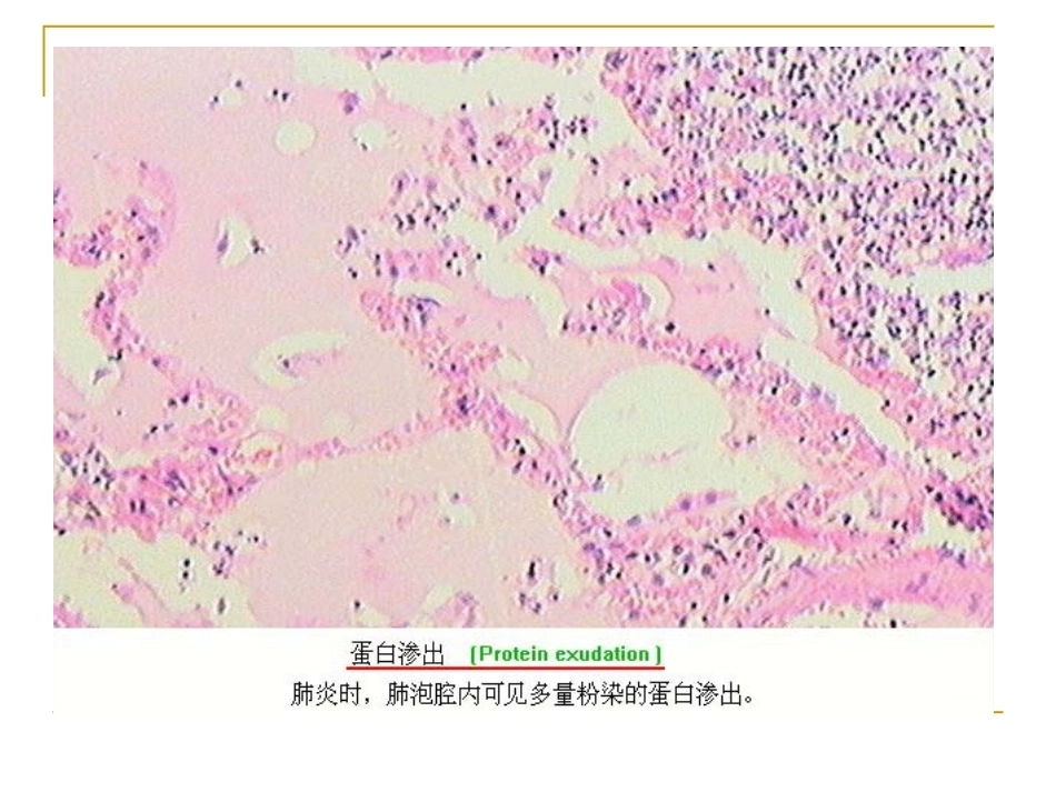 炎症病理学_第12页