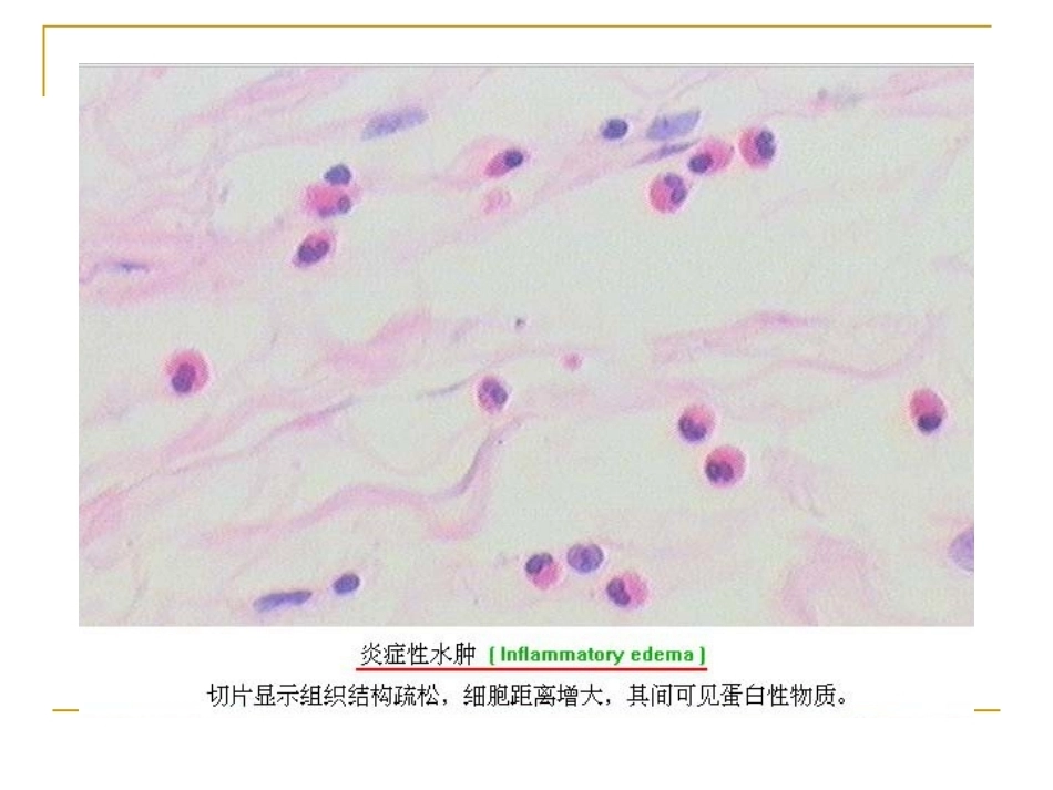 炎症病理学_第13页