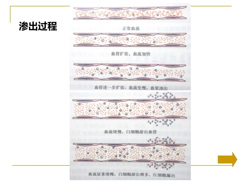 炎症病理学_第9页