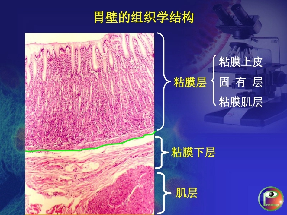 胃炎 病理学_第3页