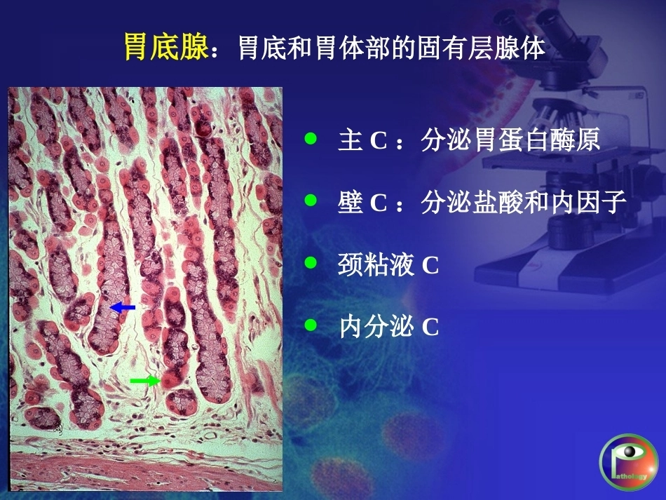 胃炎 病理学_第4页