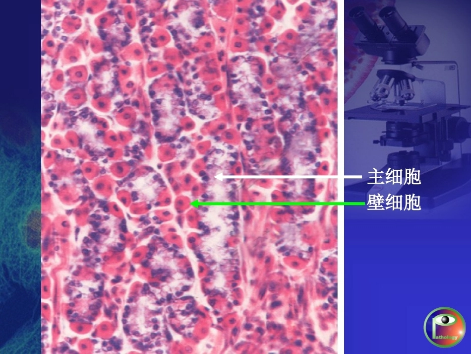 胃炎 病理学_第5页