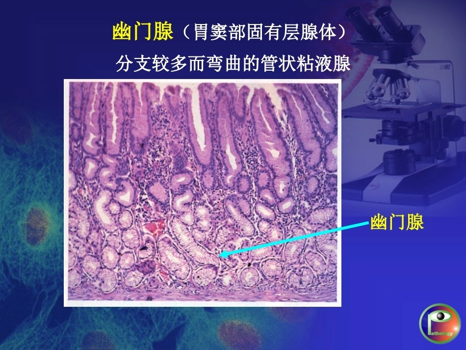 胃炎 病理学_第6页