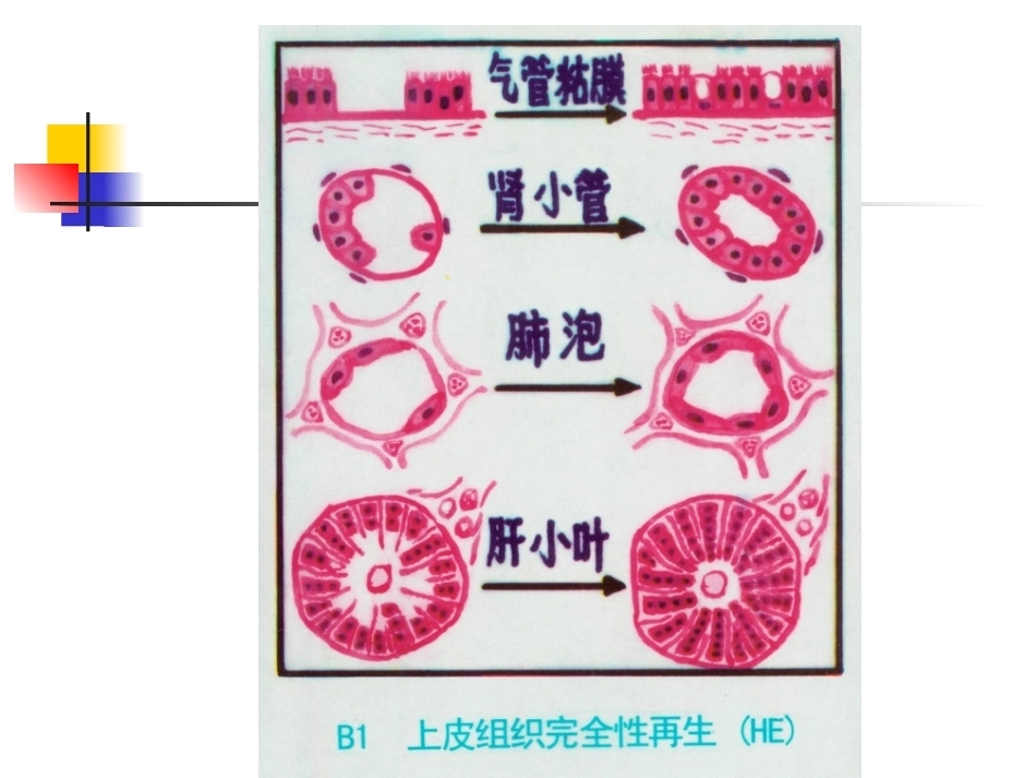 修复病理学_第15页