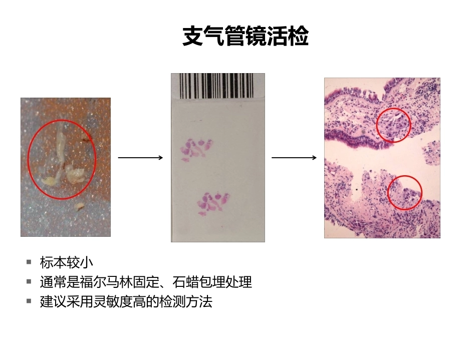 小标本和细胞学标本的基因检测(病理科)_第5页