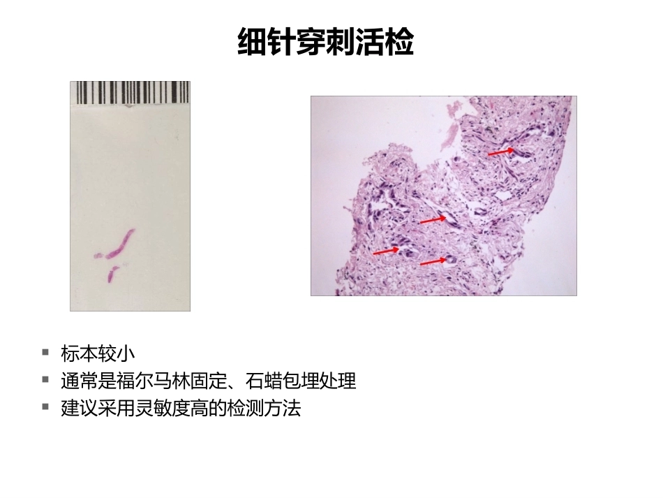 小标本和细胞学标本的基因检测(病理科)_第6页