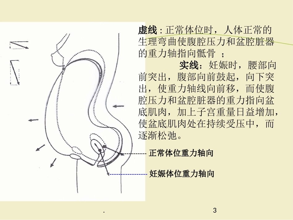 产后盆底康复PPT幻灯片_第3页