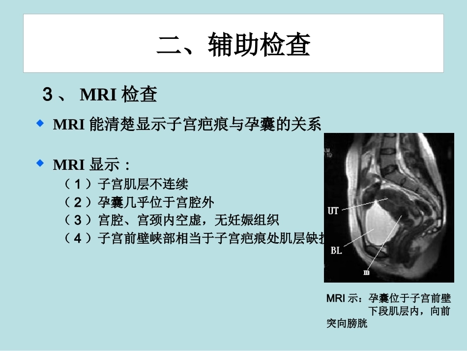 从高剖宫产率看疤痕部位妊娠_第14页