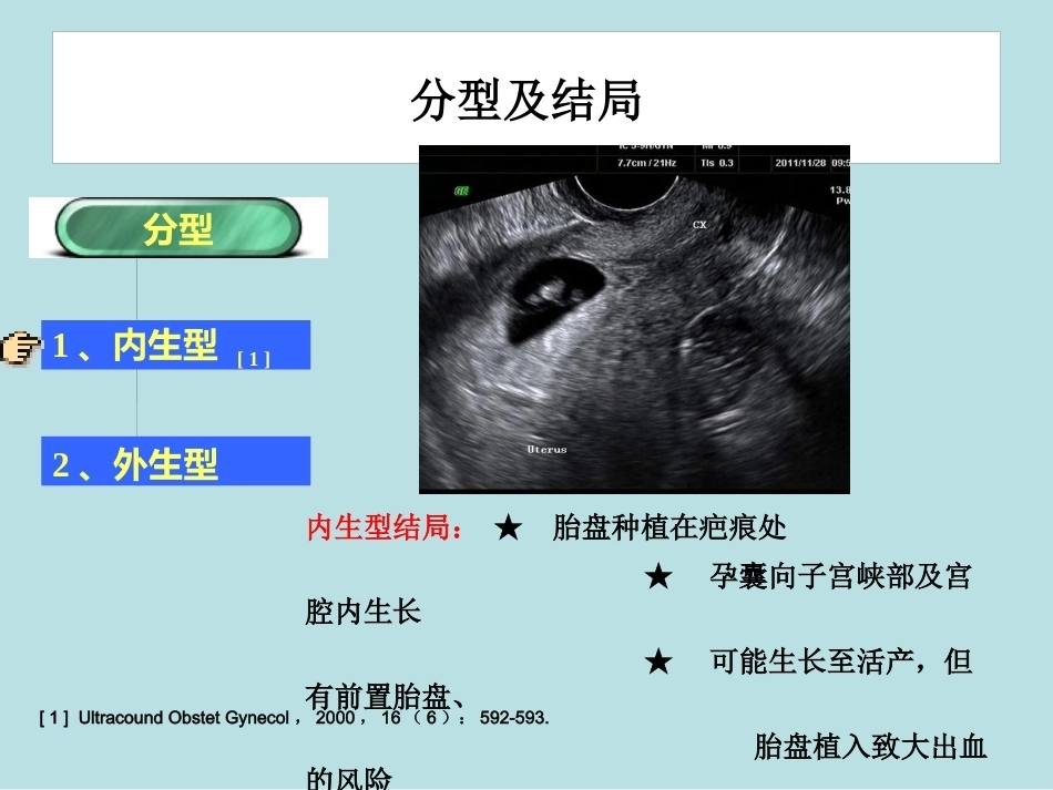 从高剖宫产率看疤痕部位妊娠_第8页